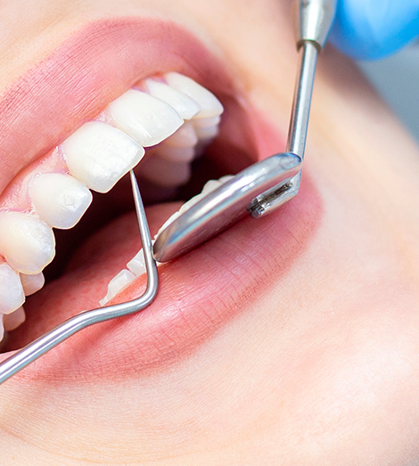 complete_dental_care_at_fho_back complete_dental_care_at_fho_back